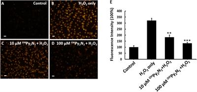 A macrocyclic molecule with multiple antioxidative activities protects the lens from oxidative damage